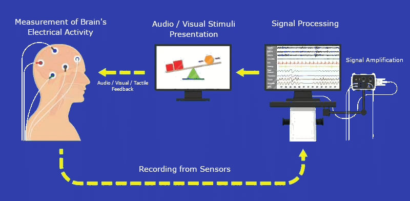 Neurofeedback Neurofeedback