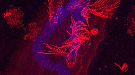 Three images taken with expansion microscopy showing the structural organisation of cells.