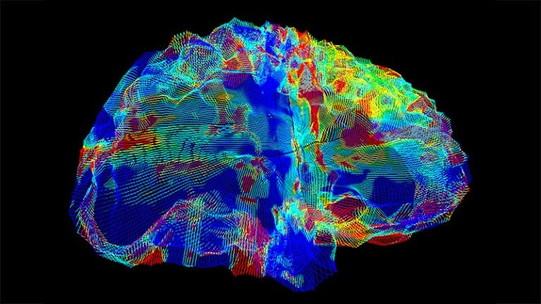 AI that reads brain scans shows promise for finding Alzheimer's genes AI that reads brain scans shows promise for finding Alzheimer's genes