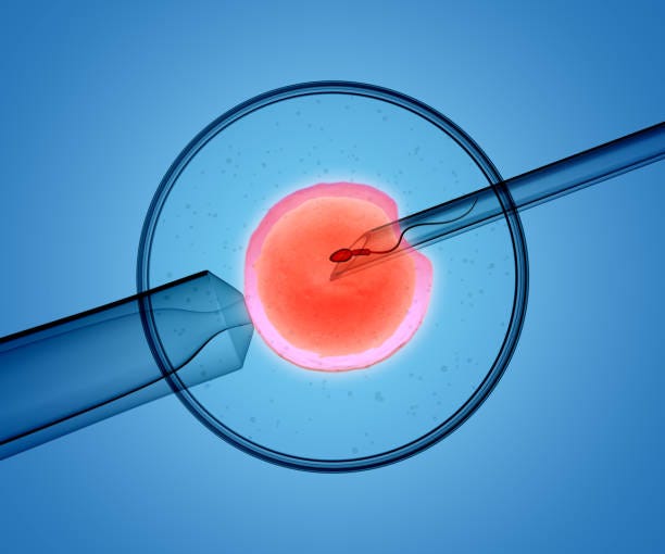 3D rendering of the icsi(intracytoplasmic sperm injection) process - in which a single sperm is injected directly into an egg 3D rendering of the icsi(intracytoplasmic sperm injection) process - in which a single sperm is injected directly into an egg ivf stock pictures, royalty-free photos & images