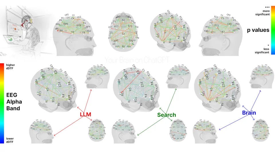 New research says using AI reduces brain activity – but, no, that doesn't  mean it's making us dumber
