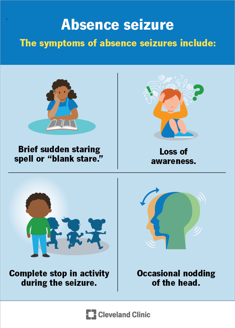 The symptoms of an absence seizure