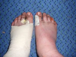 triple ironman 2010 084