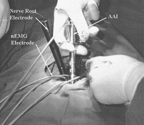 Neuromechanical characterization of in vivo lumbar spinal manipulation.  Part II. Neurophysiological response - ScienceDirect