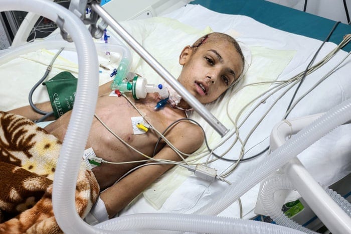 Not a normal war': doctors say children have been targeted by Israeli  snipers in Gaza | Israel-Gaza war | The Guardian