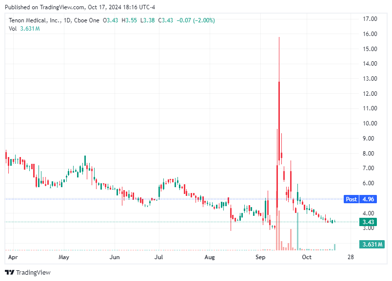 TradingView chart TradingView chart