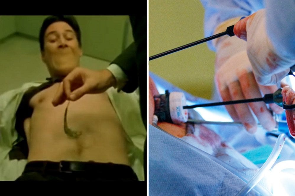 Invasion of the Body Crawlers aka Robotic Surgery 2016 images Invasion of the Body Crawlers aka Robotic Surgery 2016 images