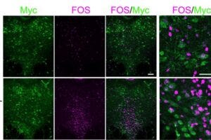 A figure from the paper illustrates that among cells expressing myc (green), a proxy for the IL-1R1 receptor, neural activation is much greater as measured with fos (magenta) when IL-1 beta was administered vs. when a control (vehicle) chemical was.