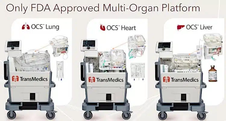 TransMedics Stock Comes Alive with Organ Transplant Tech - Nanalyze