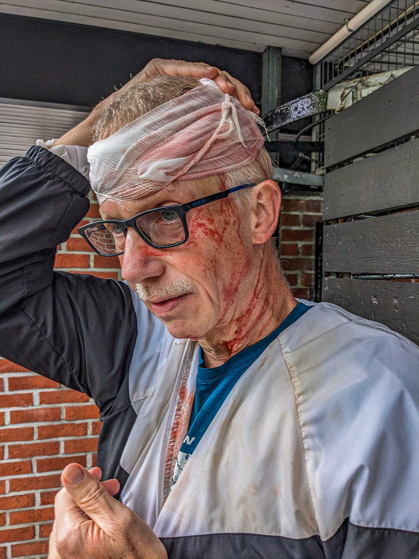 Michael with gauze wrapped his head, blood all over his face and neck. 
