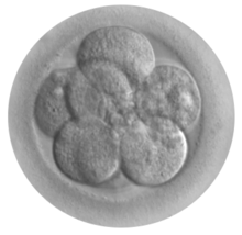 Photo of an embryo in its first stages of development. Photo of an embryo in its first stages of development.