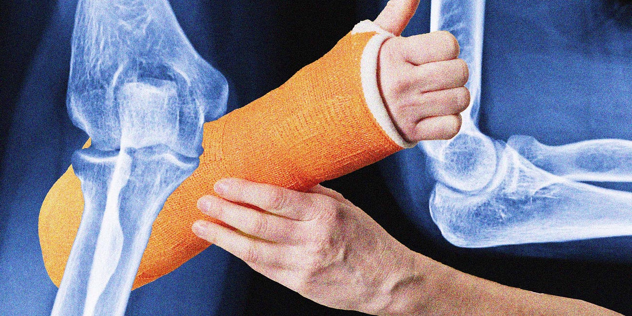 The Lesson of a Fractured Elbow
