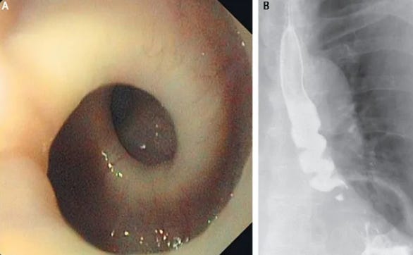 (Reprodução: New England Journal of Medicine ©2013)