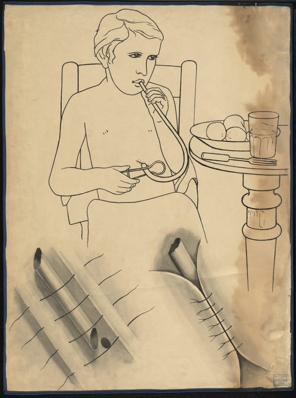 Gastic fistula