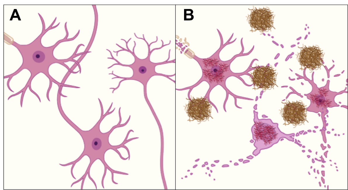 A close-up of a diagram of a brain
AI-generated content may be incorrect. A close-up of a diagram of a brain
AI-generated content may be incorrect.