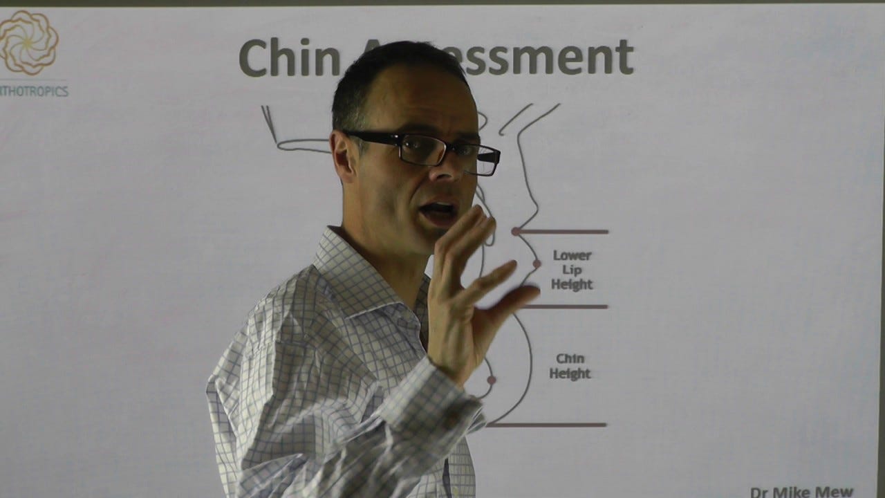 Chin Assessment - Assessing The Chin By Dr Mike Mew