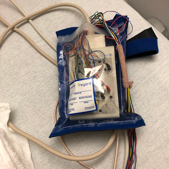 Sample gallery of the EEG stand, topped with rounded black video camera, computer screen with row after row of squiggly lines, the rectangular hanging strobe light, and the rainbow hued collection of wires inside its blue felt carry-pouch.