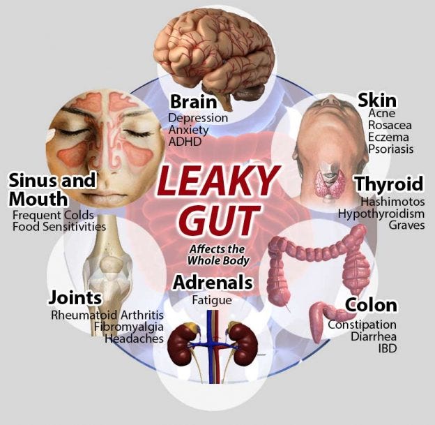 Leaky Gut Symptoms and Treatment | Sydney GP Leaky Gut Symptoms and Treatment | Sydney GP