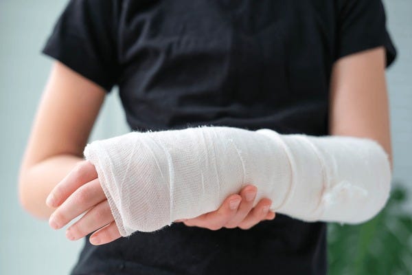 10+ Thousand Broken Hand Cast Royalty-Free Images, Stock Photos & Pictures  | Shutterstock