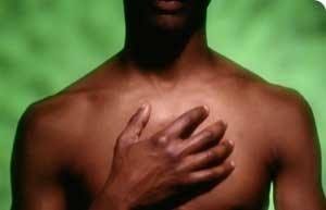 infarto miocardite