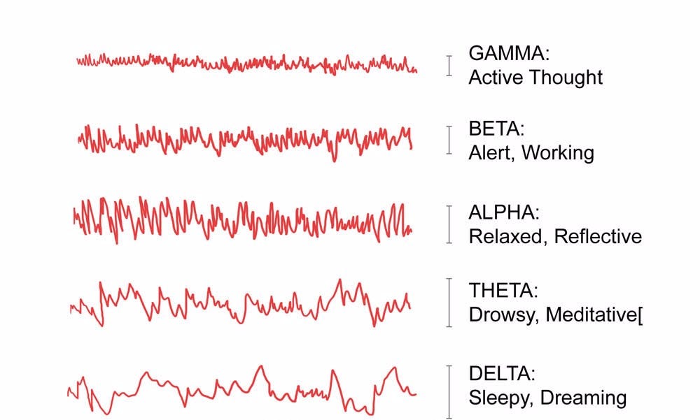 brain_waves_large.jpg