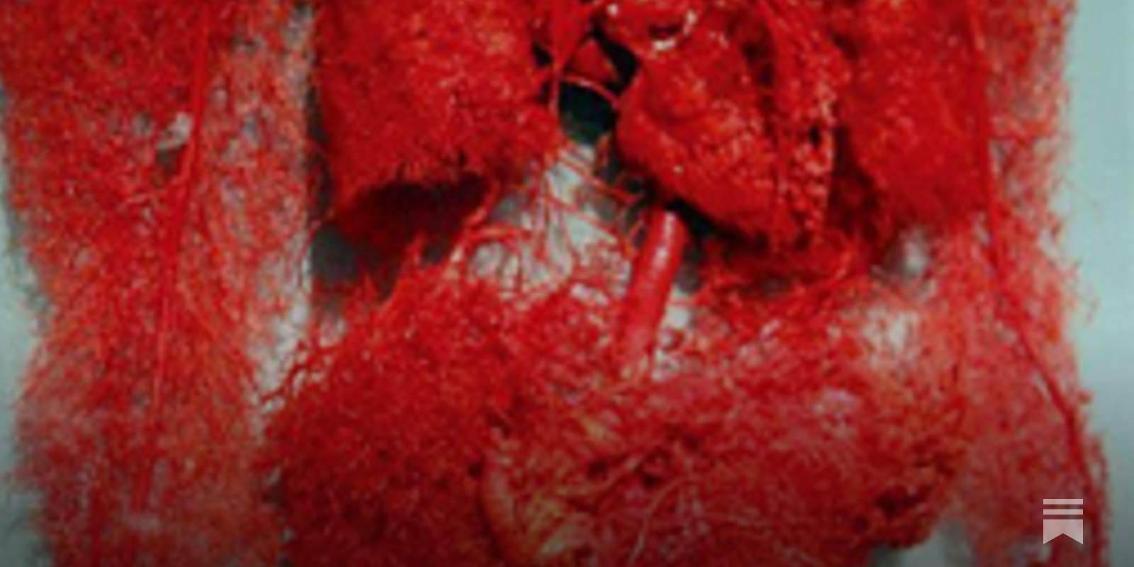 Latest: Meditation As Wakeful Relaxation: Unclenching Smooth Muscle 2026