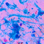 Kazakhstan, South Korea Engineer Live Bird Flu–Tuberculosis Franken-Virus: Journal ‘Veterinary World’