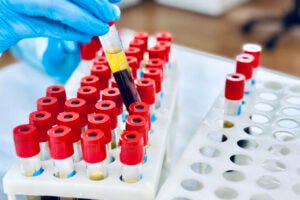laboratory technician holding a blood tube test