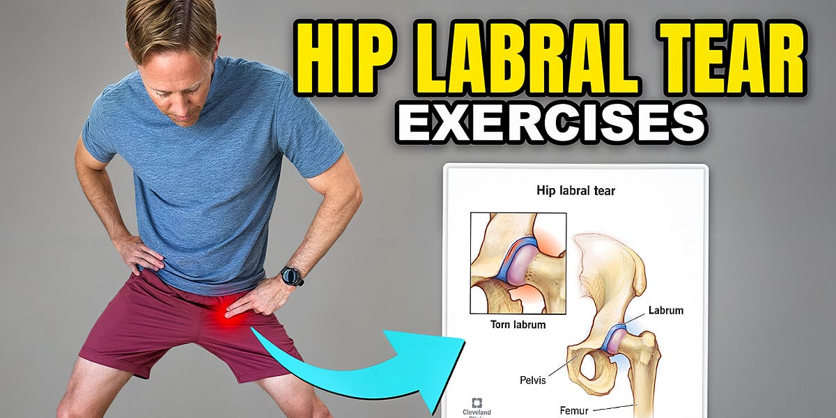 Hip Labral Tear Rehabilitation - by Dr. Tom Walters