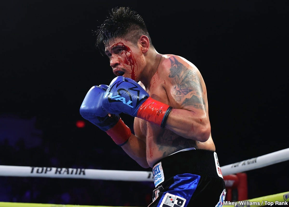 Image: "Rematch to Come" Declares Top Rank's Moretti After Injustice: Replay Shows Punch, Not Headbutt, Led to Navarrete's Cut in Disputed Decision Against Suarez
