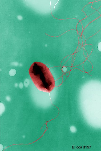 Escherichia coli flagella TEM - PICRYL - Public Domain Media Search Engine  Public Domain Image