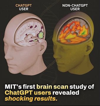 2025 MIT AI chatGPT study