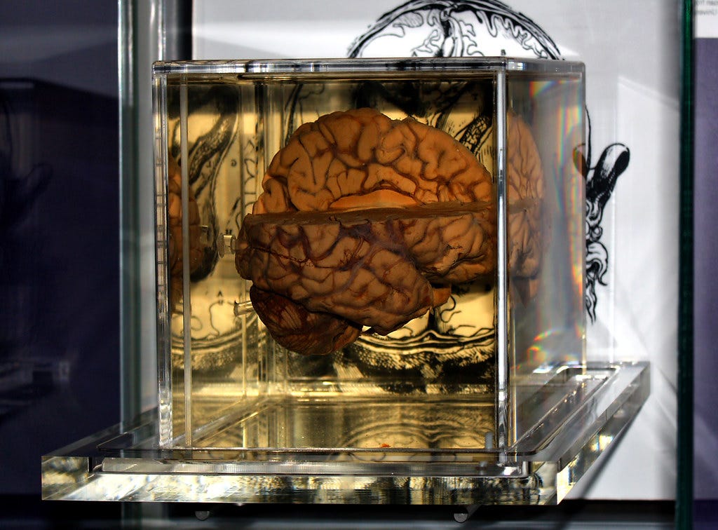 The human brain. | Yes it's real! | Andrew | Flickr The human brain. | Yes it's real! | Andrew | Flickr
