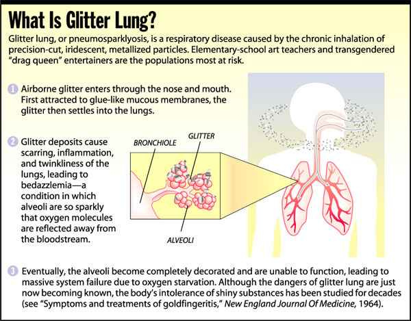 [Image shows a satirical medical infographic titled "What Is Glitter Lung?" with anatomical diagrams of lungs and respiratory system explaining a fictional respiratory condition] What Is Glitter Lung?; Glitter lung, or pneumosparklyosis, is a respiratory disease caused by the chronic inhalation of precision-cut, iridescent, metallized particles. Elementary-school art teachers and transgendered "drag queen" entertainers are the populations most at risk.; 1 Airborne glitter enters through the nose and mouth. First attracted to glue-like mucous membranes, the glitter then settles into the lungs.; 2 Glitter deposits cause scarring, inflammation, and twinkliness of the lungs, leading to bedazzlemia—a condition in which alveoli are so sparkly that oxygen molecules are reflected away from the bloodstream.; The anatomical diagram shows labels pointing to the bronchiole, glitter deposits, and alveoli within the lung illustration.; 3 Eventually, the alveoli become completely decorated and are unable to function, leading to massive system failure due to oxygen deprivation. Although the dangers of glitter lung are just now becoming known, the body's intolerance of shiny substances has been studied for decades (See "Symptoms and treatments of goldfingeritis," New England Journal of Medicine, 1964).