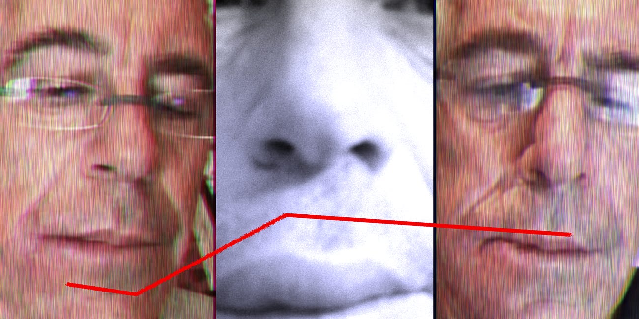 The Mystery Behind Epstein's Swollen Lips