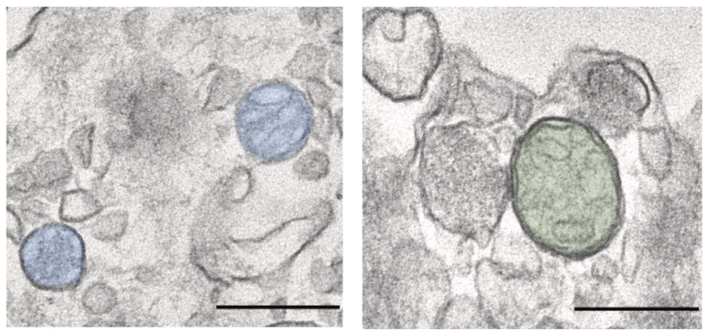 Transmission electron microscopy images of: left: two double membrane mitochondria-like particles in blue, left: one double membrane mitochondria-like particle in green.