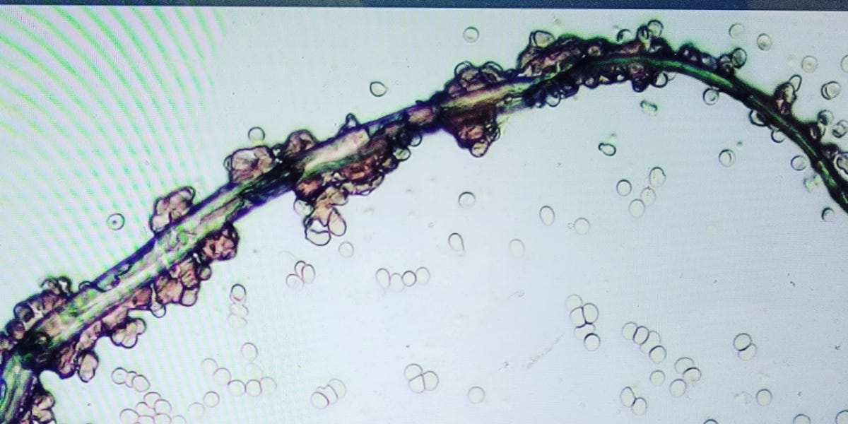 Transgenic CDB Is What Makes The Fibers We See In Humans Blood