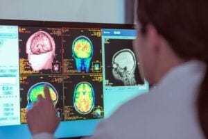 Physician reads a color monitor brain scan. From University of Michigan
