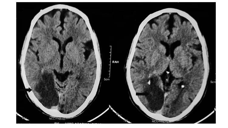(Reprodução: Pubmed)