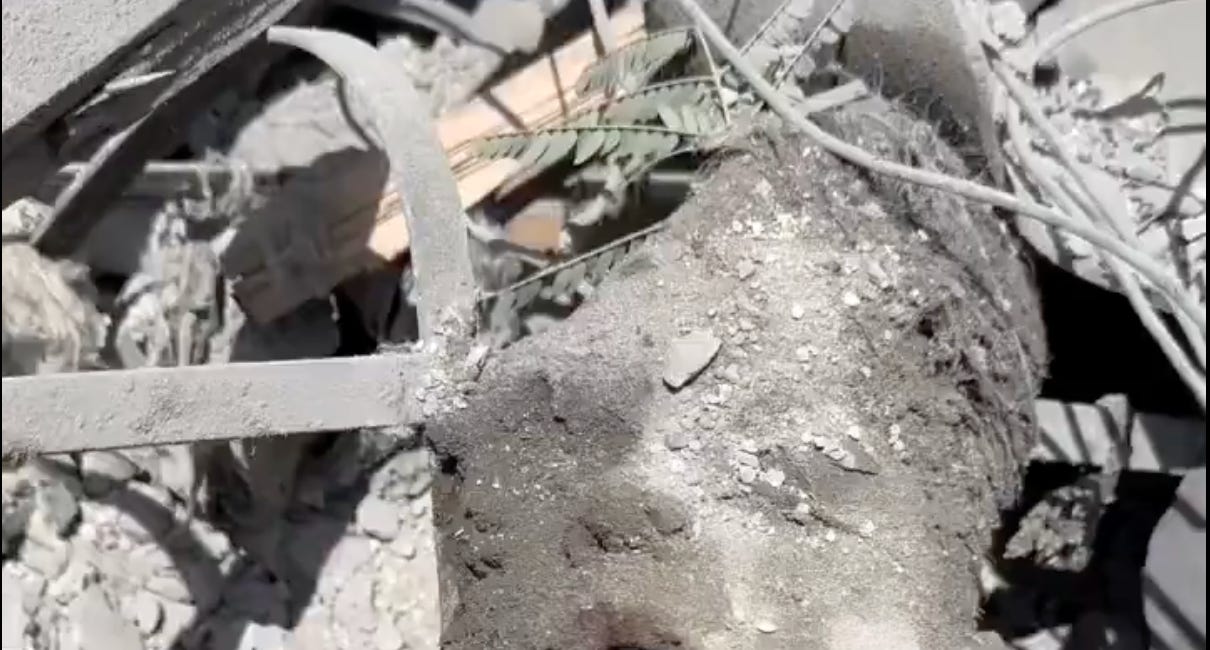 🚨 Look what they did to this poor boy. I am going to force you to see what Israel and America are doing to children in Gaza. And we are paying for this.