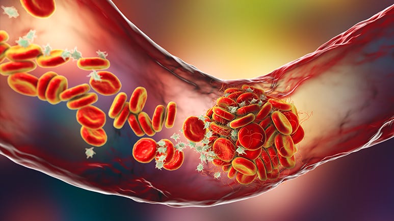 fibrinolytic enzymes for heart health