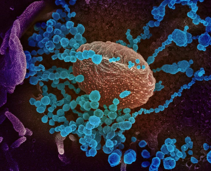 2019-nCoV onder de microscoop (NIAID, Flickr, CC BY 2.0)