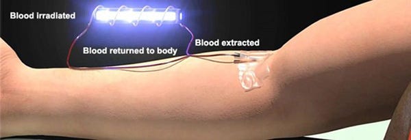 how is blood irradiated