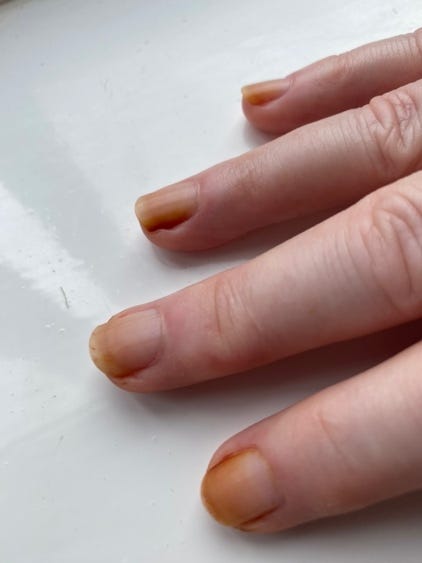 A close up of a hand

Description automatically generated