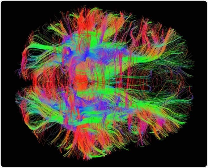 White matter fiber tracts in the adult human brain. Image Credit: Zeynep Saygin, mcgovern.mit.edu White matter fiber tracts in the adult human brain. Image Credit: Zeynep Saygin, mcgovern.mit.edu
