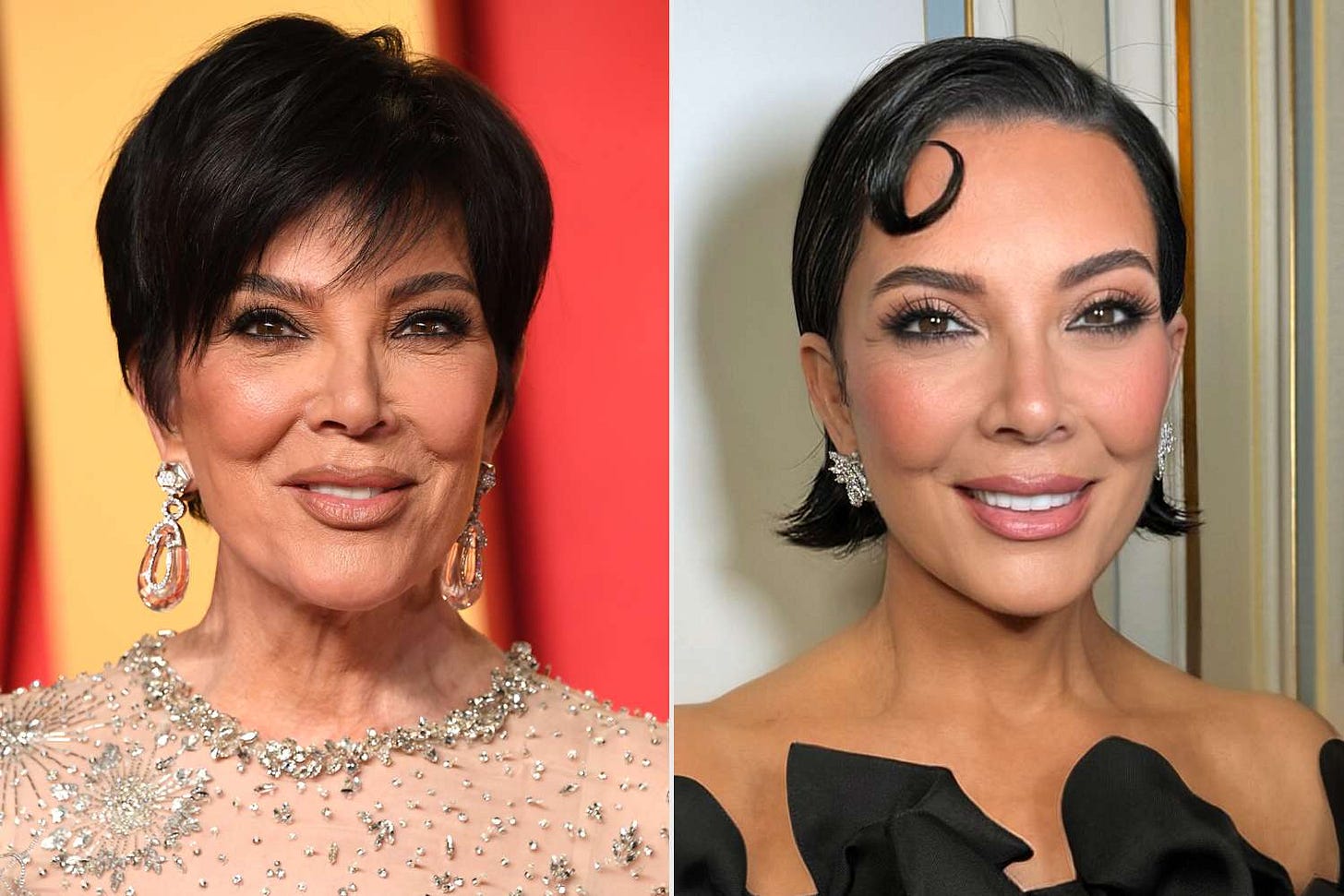 70 year old Kris Jenner pre- and post-deep plane face lift