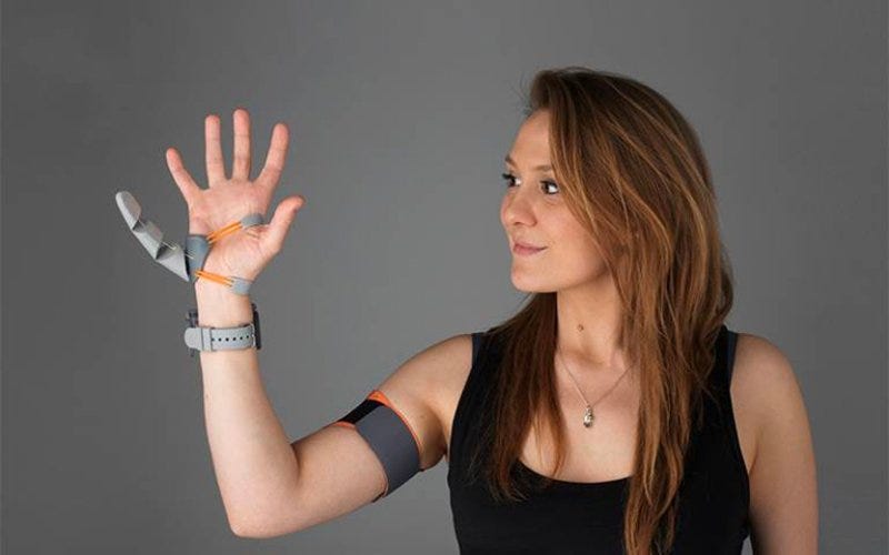 Dani Clode with the robotic thumb. (UCL)