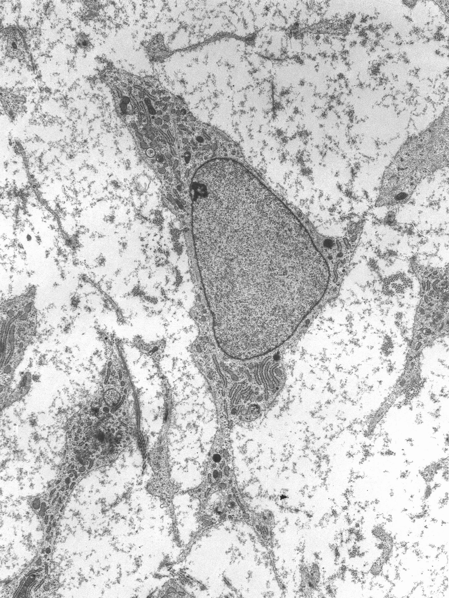 Mesenchymal stem cell - Wikipedia Mesenchymal stem cell - Wikipedia