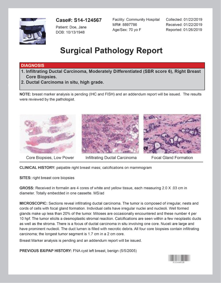 how-to-read-pathology-report-full-image