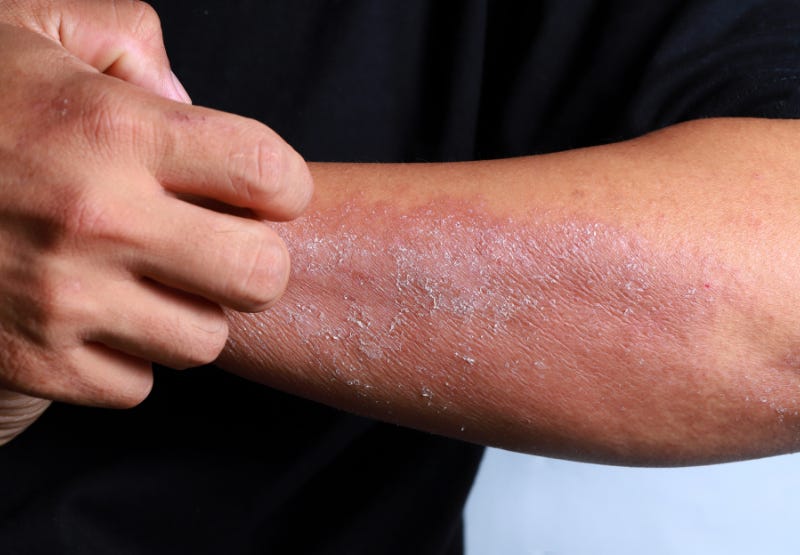 External Wound Healing & Recovery External Wound Healing & Recovery